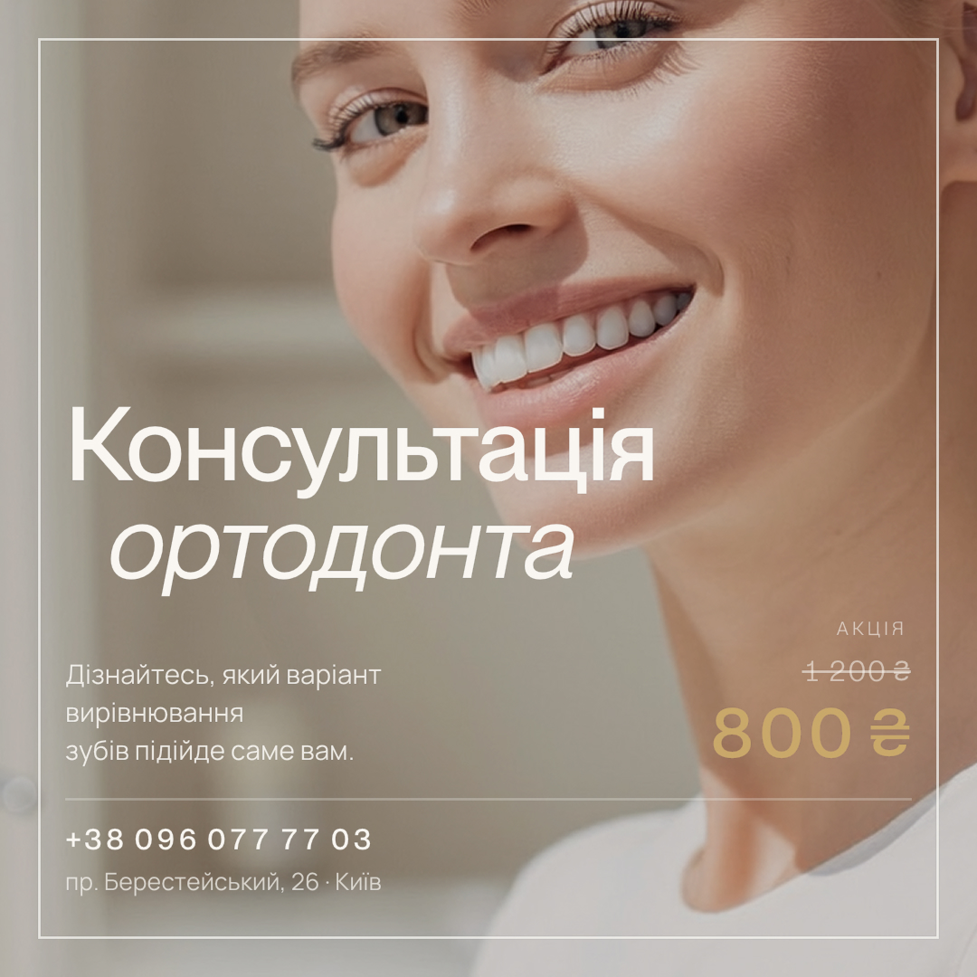 Консультація ортодонта у Seven Dent