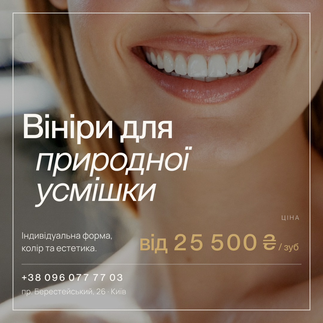 Вініри для природної усмішки у Seven Dent